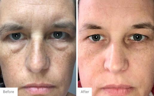 10 - Before and After Real Results photo of a woman's face.