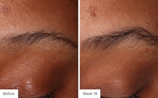 Close-up image of eyebrows showing fuller brows after 16 weeks of Lash Lush use