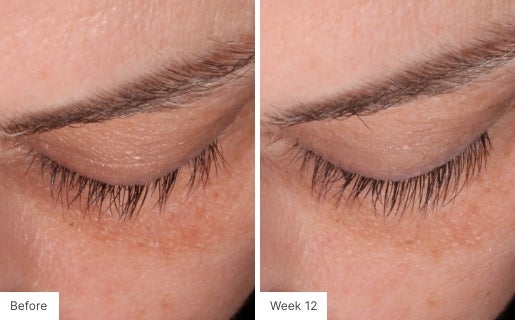 Close-up image of eyelashes showing fuller and longer lashes after 12 weeks of Lash Lush use